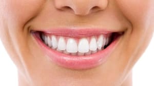 Implants and veneers top list of nation's oral health questions